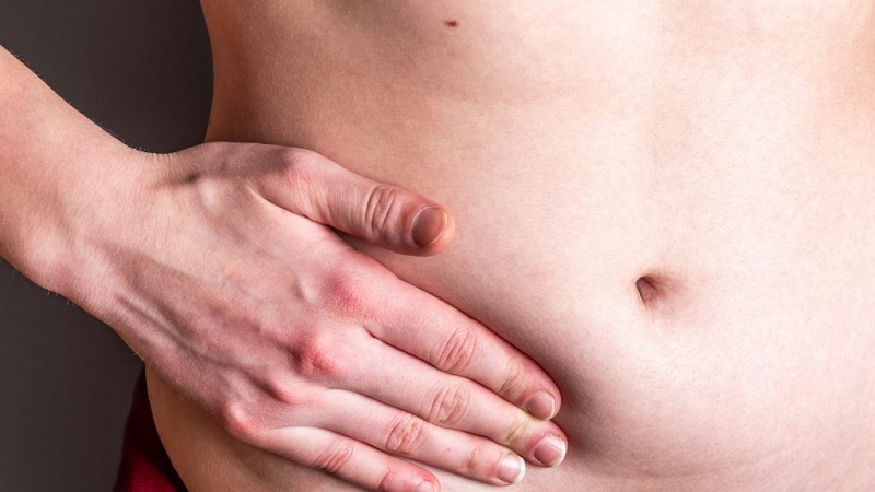 Hernia abdominal